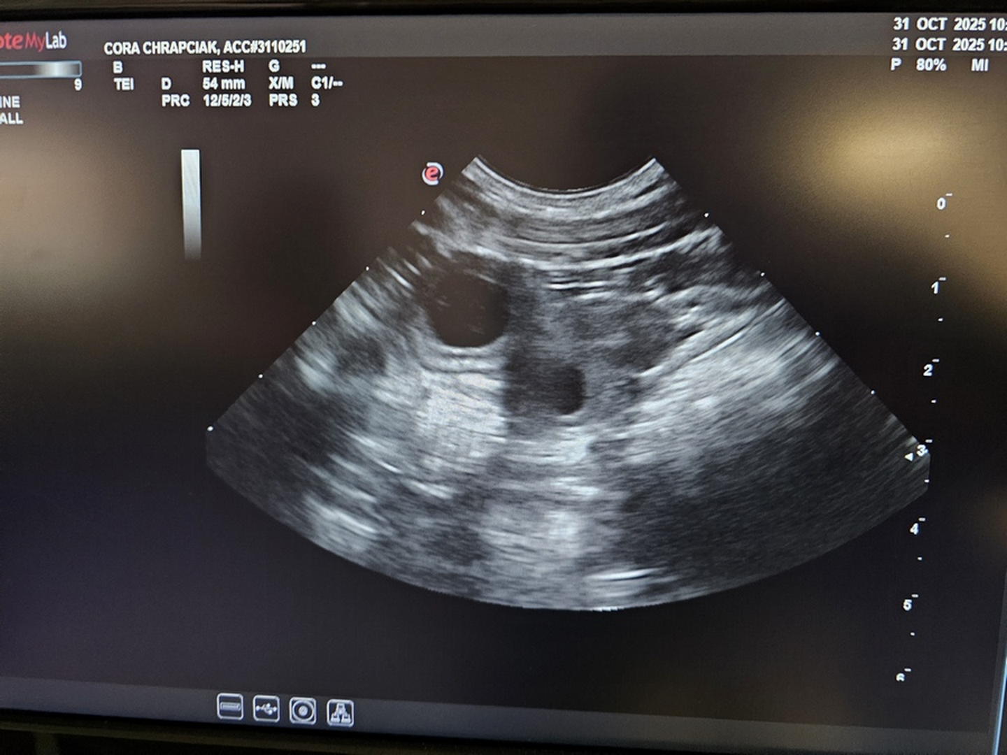 Tibetan Mastiff Puppy